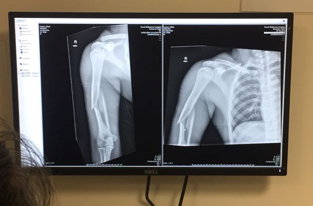 травма Карими