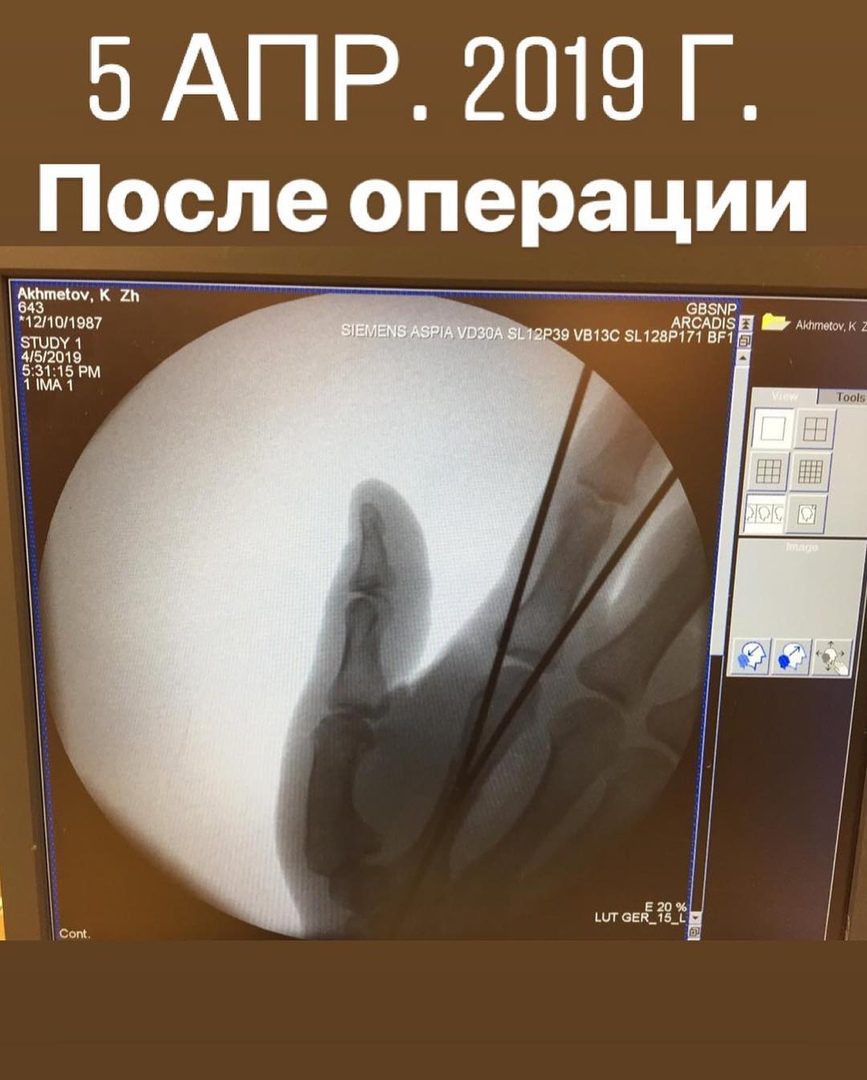 Кайрат Ахметов