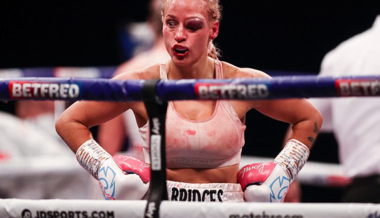 Ebanie-Bridges-Australia-with-bad-eye-injury-after-her-world-WBA-Bantamweight-defeat-over-10-rounds-against-rival-Shannon-Courtenay-England.-©-Richard-Pelham
